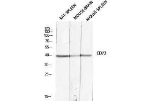 Western Blot (WB) analysis of Rat Spleen Mouse Brain Mouse Spleen lysis using CD72 antibody. (CD72 anticorps)