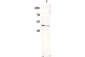Western Blot testing of anti-BPV E2 monoclonal antibody (3F12). (Bovine Papilloma Virus 1 E2 (BPV-1 E2) (AA 197-208) anticorps)