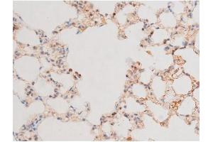 ABIN6267525 at 1/200 staining Rat lung tissue sections by IHC-P.
