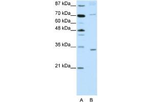 WB Suggested Anti-ATOH8 Antibody Titration:  2. (ATOH8 anticorps  (N-Term))