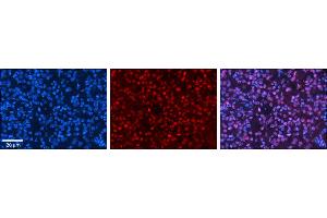 Rabbit Anti-HIPK2 Antibody     Formalin Fixed Paraffin Embedded Tissue: Human Pineal Tissue  Observed Staining: Nuclear in pinealocytes & intersticial cells  Primary Antibody Concentration: 1:100  Other Working Concentrations: 1/600  Secondary Antibody: Donkey anti-Rabbit-Cy3  Secondary Antibody Concentration: 1:200  Magnification: 20X  Exposure Time: 0. (HIPK2 anticorps  (Middle Region))