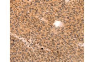 Immunohistochemistry (IHC) image for anti-Myosin Regulatory Light Polypeptide 9 (MYL9) (AA 1-100) antibody (ABIN3023463)