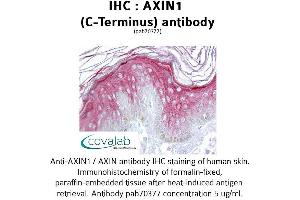 Image no. 1 for anti-Axin 1 (AXIN1) (C-Term) antibody (ABIN1732155) (Axin anticorps  (C-Term))
