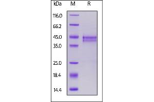 Biotinylated Human CTGF, His,Avitag (recommended for biopanning) on  under reducing (R) condition.