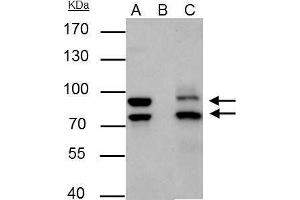 IP Image MDM2 antibody immunoprecipitates MDM2 protein in IP experiments. (MDM2 anticorps  (Center))