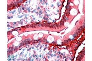 Image no. 1 for anti-Fatty Acid Binding Protein 2, Intestinal (FABP2) (C-Term) antibody (ABIN374817) (FABP2 anticorps  (C-Term))
