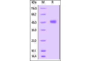 Human TIGIT, mouse IgG2a Fc tag on SDS-PAGE under reducing (R) condition. (TIGIT Protein (AA 22-141) (Fc Tag))