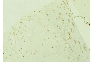 ABIN6276619 at 1/100 staining Mouse brain tissue by IHC-P.