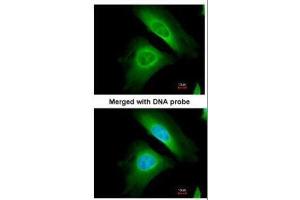 ICC/IF Image Immunofluorescence analysis of paraformaldehyde-fixed HeLa, using Optineurin, antibody at 1:200 dilution.