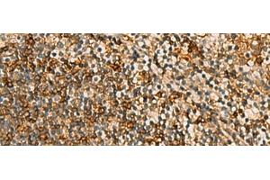 Immunohistochemistry of paraffin-embedded Human tonsil tissue using HORMAD2 Polyclonal Antibody at dilution of 1:45(x200)