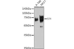 Western blot analysis of extracts of various cell lines, using 5T4 Rabbit mAb (ABIN7271009) at 1:1000 dilution. (TPBG anticorps)