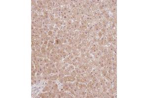 Immunohistochemical analysis of C on paraffin-embedded Human liver tissue.