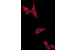 Immunofluorescent analysis of E Cadherin staining in PC12 cells.