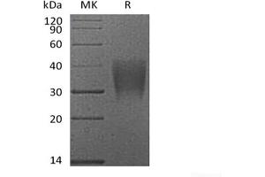 Western Blotting (WB) image for CD28 (CD28) (Active) protein (His tag) (ABIN7319757)