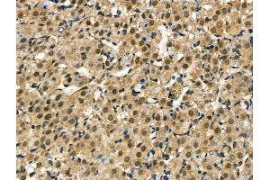 ABIN6260516 and ABIN6267035 at 1/100 staining Rat ovarian tissue by IHC-P. (CBP anticorps  (C-Term))