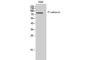 Western Blotting (WB) image for anti-P-Cadherin (CDH3) (N-Term) antibody (ABIN3180797) (P-Cadherin anticorps  (N-Term))