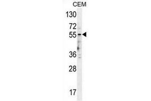 5HT3E Antibody (HTR3E anticorps  (Middle Region))