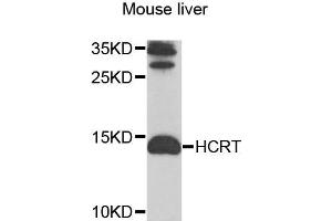 Western blot analysis of extracts of mouse liver cells, using HCRT antibody. (Orexin anticorps)