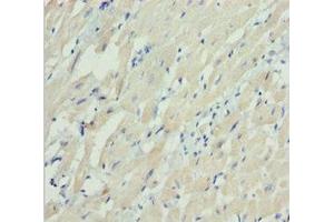 Immunohistochemistry of paraffin-embedded human heart tissue using ABIN7160533 at dilution of 1:100 (MYL3/CMLC1 anticorps  (AA 1-195))
