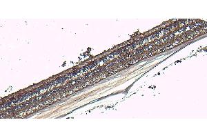 ABIN570667 (2. (ARR3 anticorps  (C-Term))
