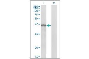 Western Blotting (WB) image for anti-Sprouty Homolog 1, Antagonist of FGF Signaling (SPRY1) antibody (ABIN781897)