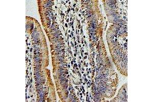 Immunohistochemistry (IHC) image for anti-Pregnancy Specific beta-1-Glycoprotein 1 (PSG1) antibody (ABIN7308238) (PSG1 anticorps)