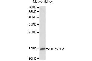 Western blot analysis of extracts of mouse kidney, using ATP6V1G3 antibody (ABIN6290037) at 1:1000 dilution. (ATP6V1G3i anticorps)