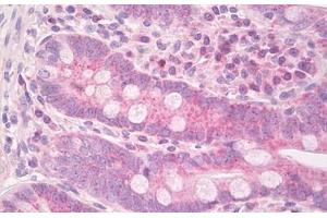 Image no. 2 for anti-ISG15 Ubiquitin-Like Modifier (ISG15) (AA 80-129) antibody (ABIN6749770)