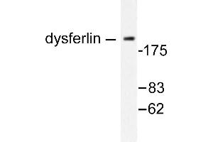 Image no. 1 for anti-Dysferlin (DYSF) antibody (ABIN265388) (Dysferlin anticorps)