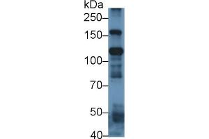 Detection of ITIH4 in Human Placenta lysate using Polyclonal Antibody to Inter Alpha-Globulin Inhibitor H4 (ITIH4)