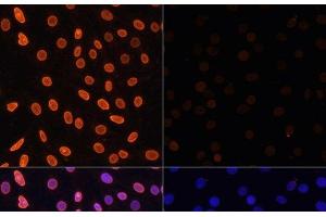 Immunofluorescence analysis of C6 cells using Acetyl-Histone H3-K36 Polyclonal Antibody at dilution of 1:100. (Histone 3 anticorps  (acLys36))