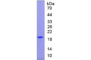 Rabbit Detection antibody from the kit in WB with Positive Control: Lane 1: Mouse liver, Lane 2: Mouse bladder, Lane 3: Mouse ovary. (SOD1 Kit ELISA)