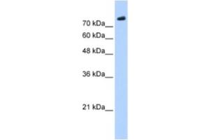 Western Blotting (WB) image for anti-PHD Finger Protein 20 (PHF20) antibody (ABIN2461244) (PHF20 anticorps)
