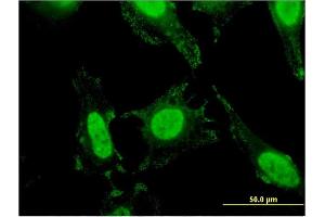Immunofluorescence of monoclonal antibody to SLC4A1 on HeLa cell.