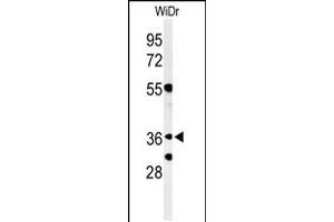 Western blot analysis of NSE4A Antibody in WiDr cell line lysates (35ug/lane) (NSMCE4A anticorps  (N-Term))
