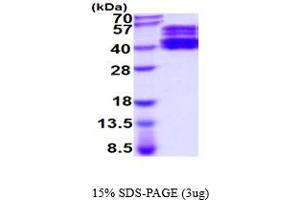 SDS-PAGE (SDS) image for ST6 beta-Galactosamide alpha-2,6-Sialyltranferase 1 (ST6GAL1) (AA 27-406) protein (His tag) (ABIN5854563)
