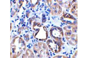 Immunohistochemistry of ACE2 in human kidney tissue with ACE2 polyclonal antibody  at 2 ug/mL .