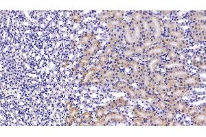 Detection of HIF1a in Mouse Kidney Tissue using Polyclonal Antibody to Hypoxia Inducible Factor 1 Alpha (HIF1a)