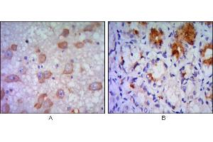 Immunohistochemical analysis of paraffin-embedded human brain tissue (A) and stomach tissue (B), showing cytoplasmic localization using ERN1 mouse mAb with DAB staining.