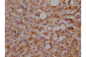 IHC image of ABIN7127599 diluted at 1:100 and staining in paraffin-embedded human liver tissue performed on a Leica BondTM system. (Recombinant LDLR anticorps)
