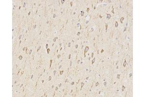 anti-LC3A / LC3B antibody