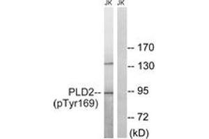 Western blot analysis of extracts from Jurkat cells treated with TNF 20ng/ml 30', using PLD2 (Phospho-Tyr169) Antibody. (Phospholipase D2 anticorps  (pTyr169))