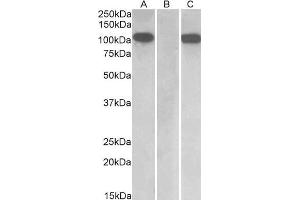 HEK293 lysate (10 µg protein in RIPA buffer) overexpressing Human Furin with C-terminal MYC tag probed with ABIN1590028 (1 µg/mL) in Lane A and probed with anti-MYC Tag (1/1000) in lane C. (FURIN anticorps  (Internal Region))