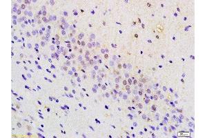 Formalin-fixed and paraffin embedded mouse brain tissue labeled with Anti-BRN3A Polyclonal Antibody, Unconjugated at 1:200 followed by conjugation to the secondary antibody, (SP-0023), and DAB staining (POU4F1 anticorps  (AA 325-419))