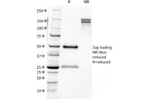 SDS-PAGE Analysis Purified CD9 Mouse Monoclonal Antibody (CD9/1631). (CD9 anticorps)