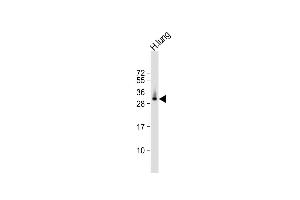Anti-ELOVL6 Antibody (N-term) at 1:1000 dilution + human lung lysate Lysates/proteins at 20 μg per lane. (ELOVL6 anticorps  (N-Term))