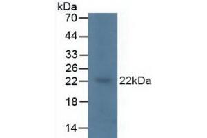 Detection of KRAS in Porcine Brain Tissue using Polyclonal Antibody to V-Ki-Ras2 Kirsten Rat Sarcoma Viral Oncogene Homolog (KRAS) (K-RAS anticorps  (AA 1-189))