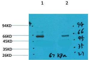Western Blot (WB) analysis of 1) Mouse Brain Tissue, 2)Rat Brain Tissue with GABA Transporter 1 Rabbit Polyclonal Antibody diluted at 1:2000. (SLC6A1 anticorps)