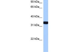WB Suggested Anti-GIMAP1 Antibody Titration:  0. (GTPase, IMAP Family Member 1 (GIMAP1) (N-Term) anticorps)