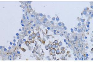 Immunohistochemistry of paraffin-embedded Mouse testis using NRG4 Polyclonal Antibody at dilution of 1:200 (40x lens). (Neuregulin 4 anticorps)